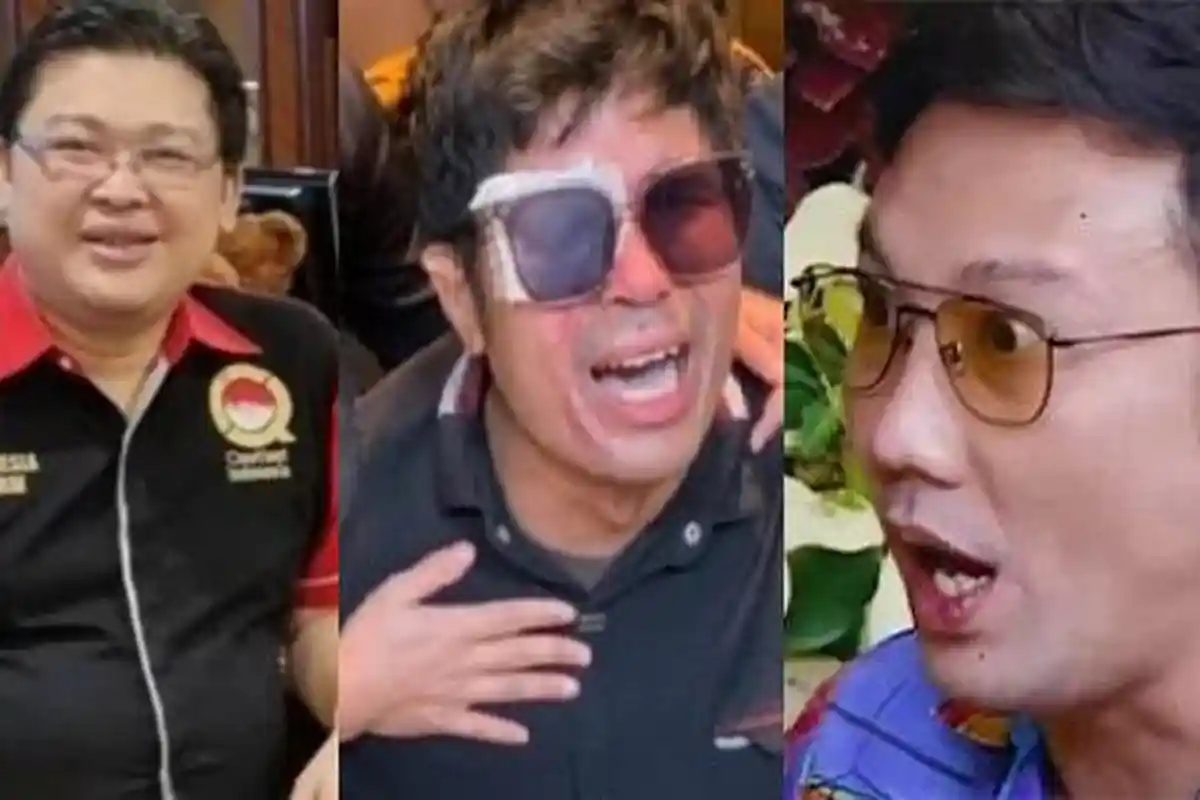 JAWABAN Denny Sumargo Usai Ditantang Alvin Lim Siram Air Keras Hadiah Rp3 M: Kasih Agus Aja Bang
