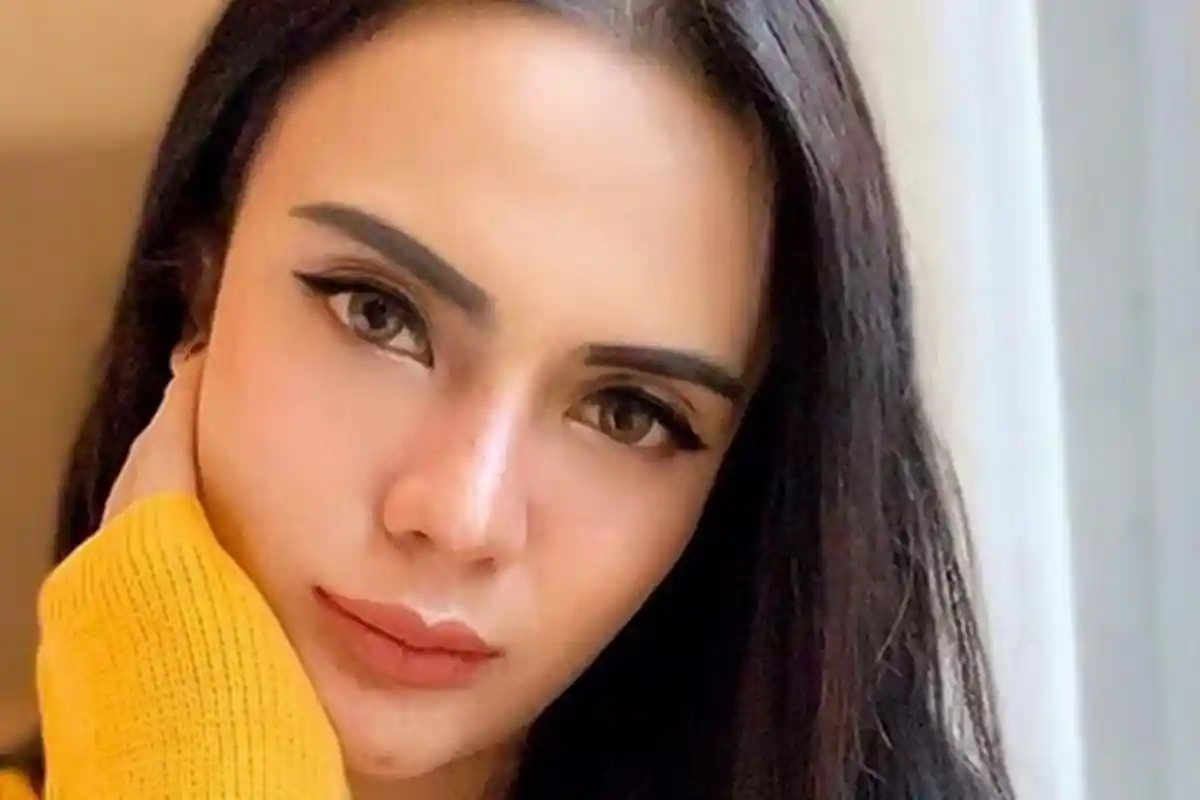 Ingat Anggita Sari? Model Cantik yang Dulu Sempat Heboh, Kondisi Wajahnya Berubah dan Kesakitan