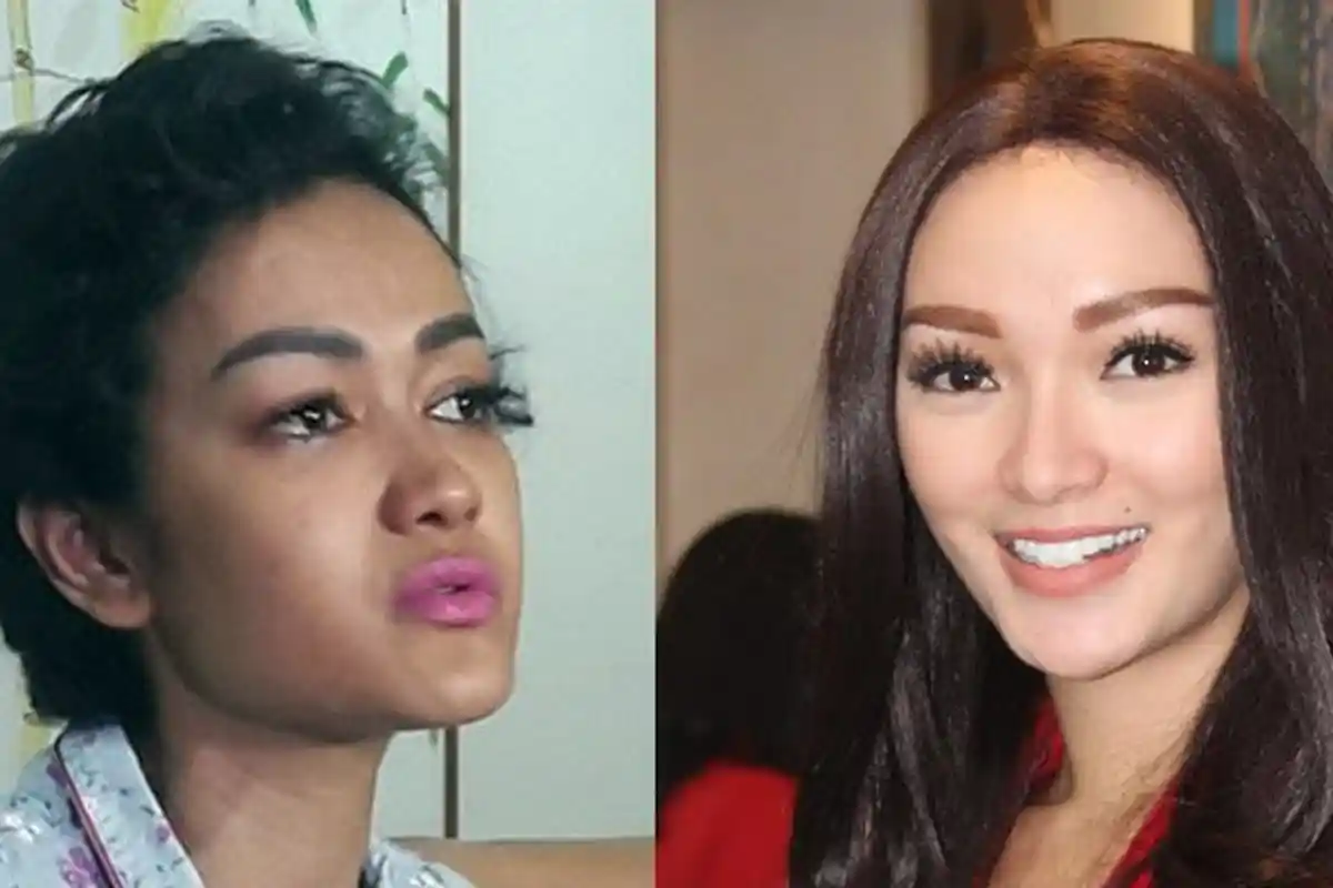 Masih Lemah, Julia Perez Telepon Zaskia Gotik Untuk Katakan Hal Ini