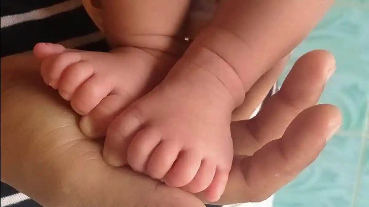 Viral Kakak Beradik Galuh dan Galih Memiliki 24 Jari Tangan dan Kaki