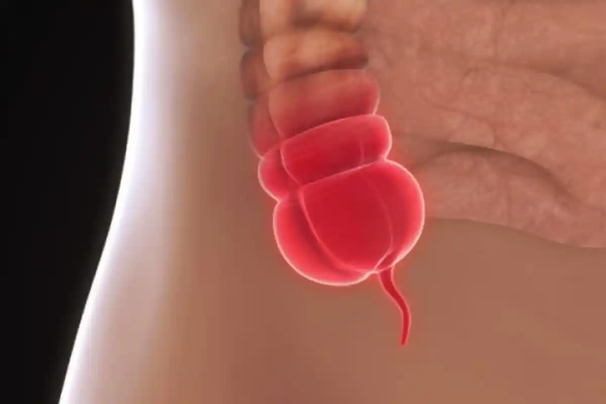 Usus Buntu, Berukuran Sekitar 2-4 Inci, Merupakan Bagian Menonjol di Ujung Usus Besar