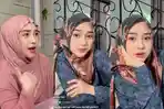 Ria-Ricis-tampil-dengan-hidung-mancung-adik-Oki-Setiana-Dewi.jpg