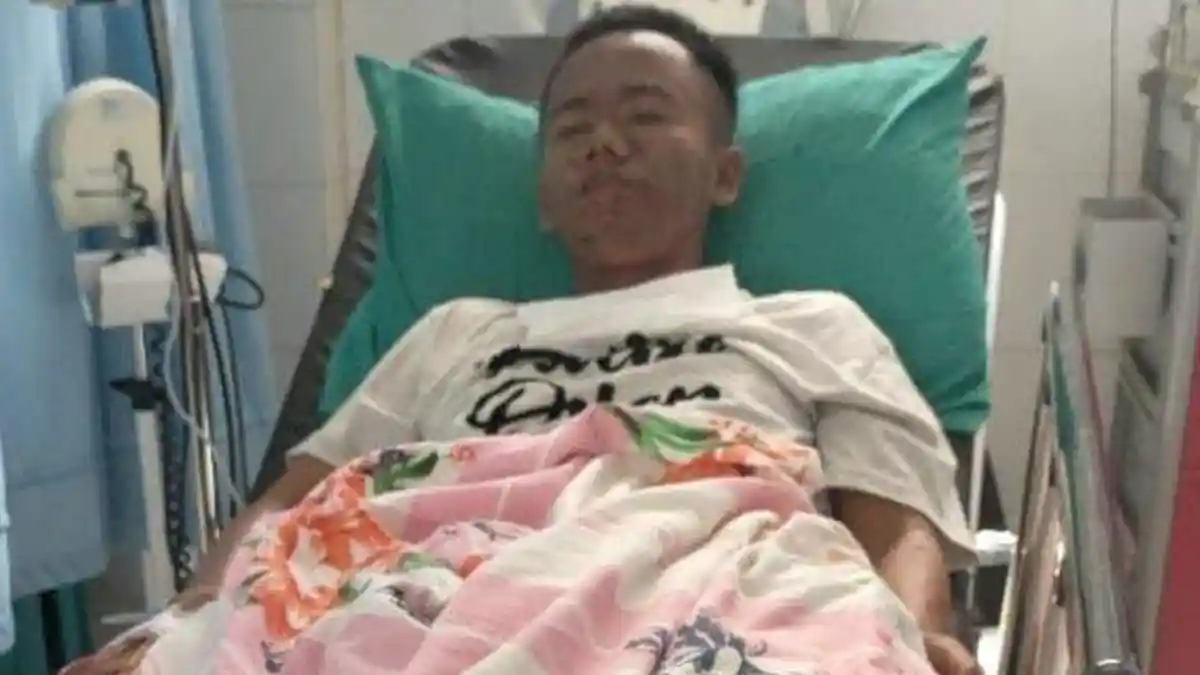 Pilu Anak Berkebutuhan Khusus Dibully hingga Kulit Melepuh seperti Gosong, Diduga Dicekoki Miras