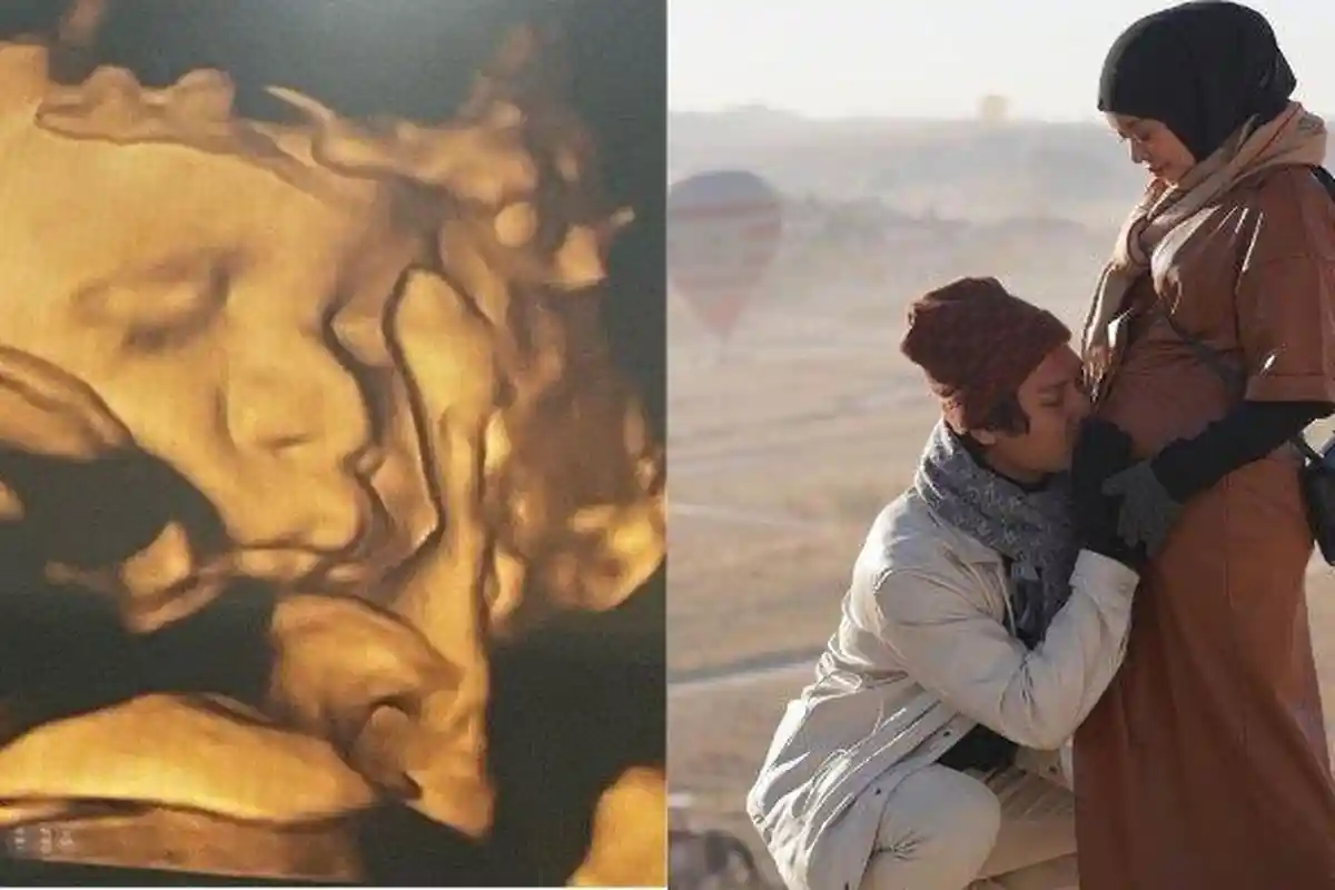 Periksa Kandungan, Lesti Kejora Alami Kejadian Tidak Terduga, Tegur Dokter karena Tidak Terima