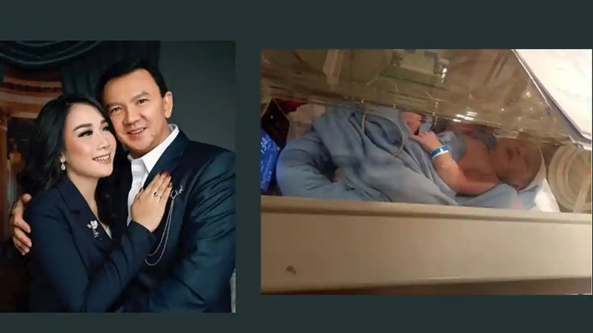 Potret Raut Bahagia Puput Nastiti Devi setelah Melahirkan, Dikunjungi Anya Dwinov dan Rico Ceper