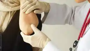 penyakit-psoriasis-1232.jpg