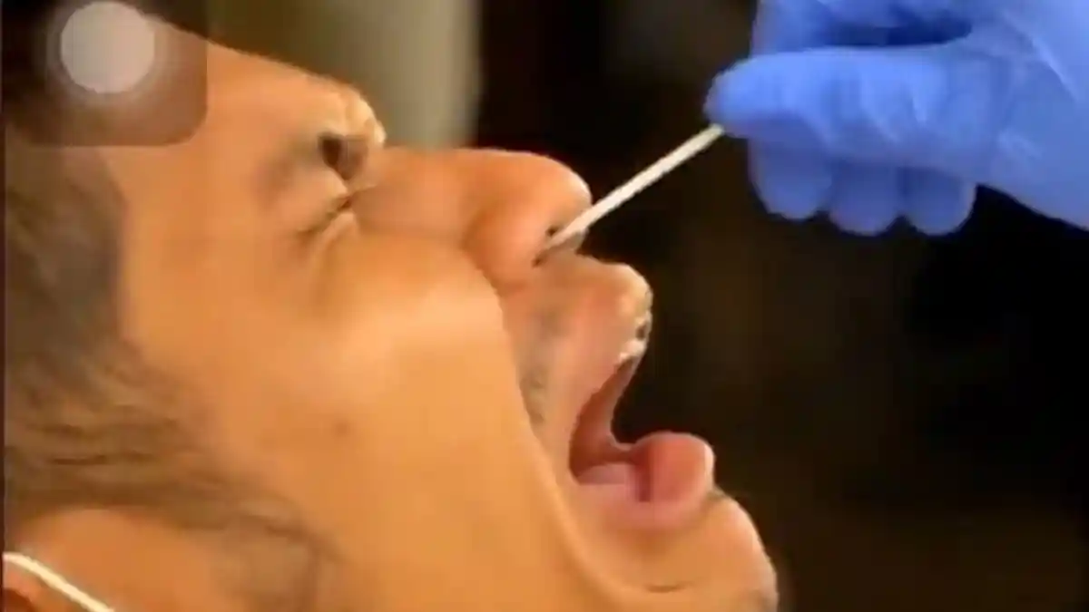 Alat Rapid Test Bekas dari Mulut Orang Dipakai ke Orang Lain di Bandara Kualanamu, Dinkes: Pidanakan