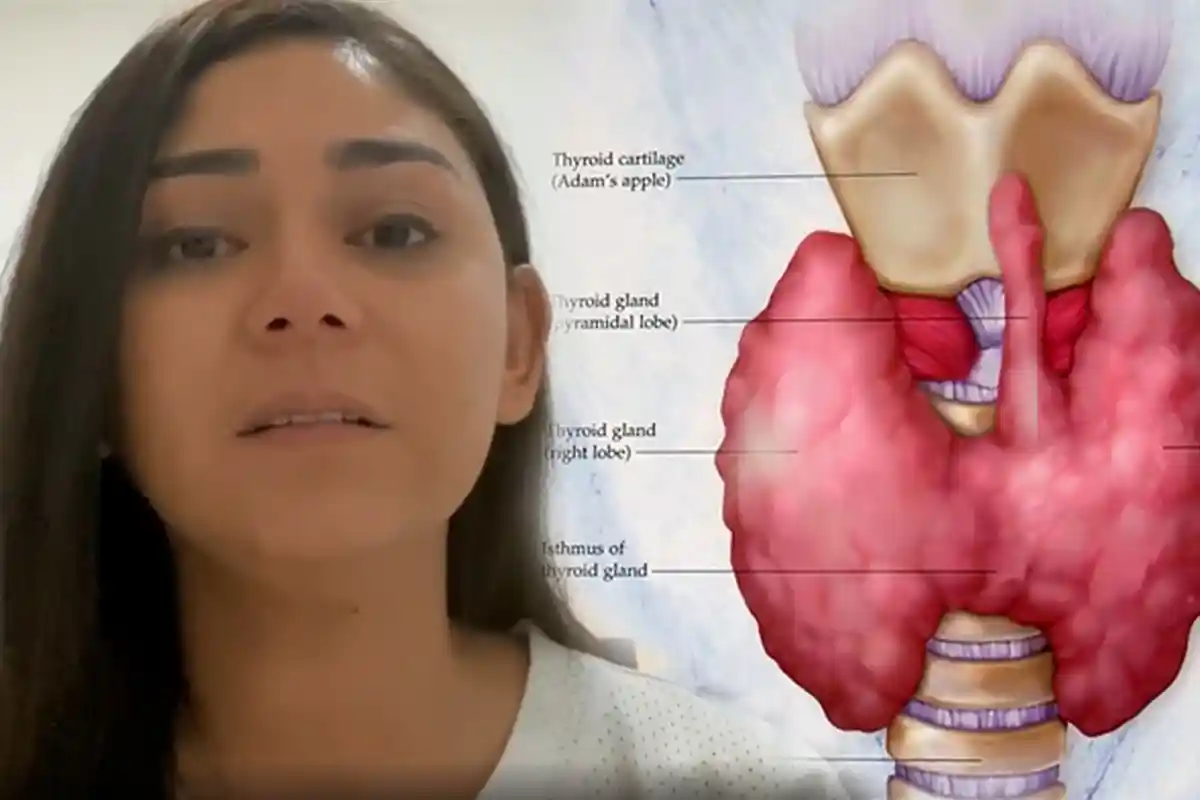 Thalita Latief Terkena Tumor Tiroid dan Berhasil Dioperasi, Berikut 7 Gejala yang Kerap Diabaikan