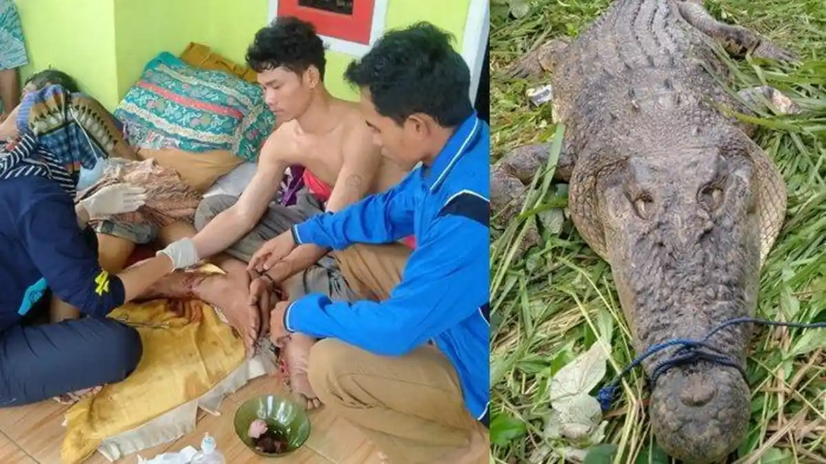 Niat Mencari Ikan di Sungai, Pria Pandeglang Ini Malah Digigit Buaya