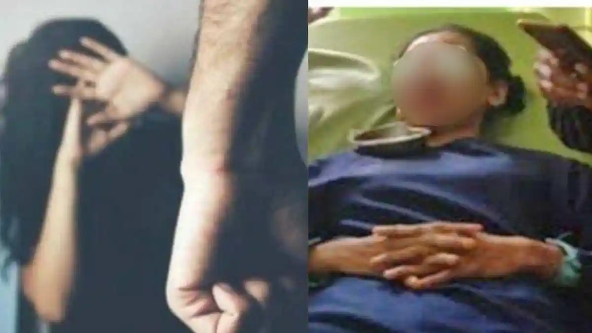 Cinta Ditolak, Sukarji Siramkan Air Keras ke Wajah Guru TK