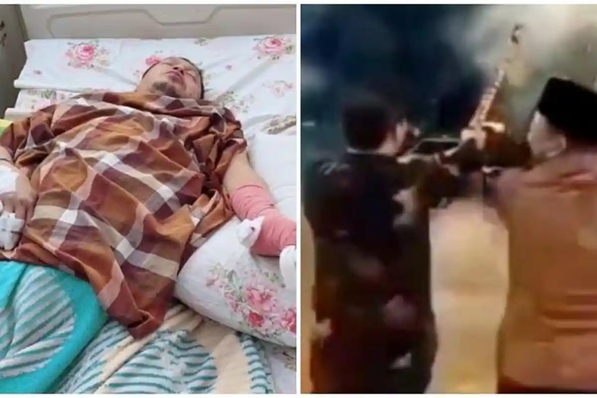 Terungkap Kondisi Terkini Wakil Bupati Kaur, Jari Tangan di Operasi Usai Kena Ledakan Kembang Api