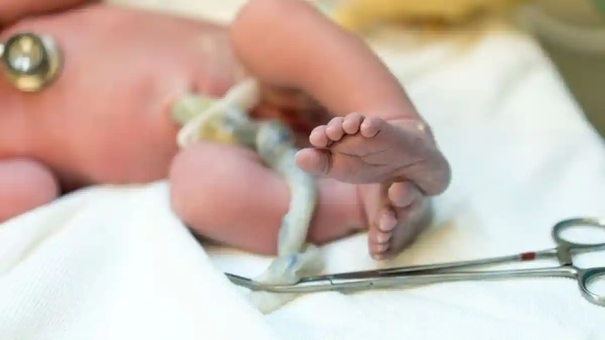 Kasus Pertama di Dunia, Bayi di Irak Lahir dengan 3 Penis