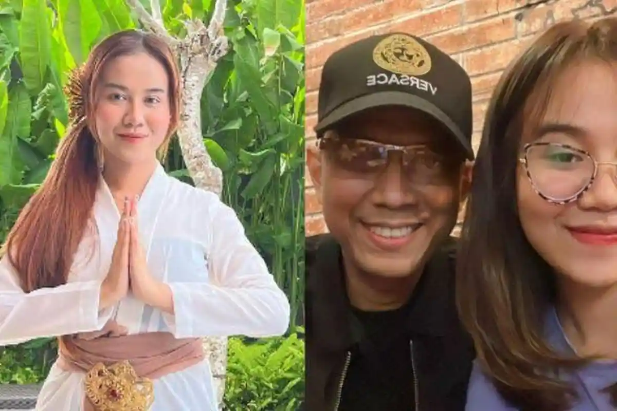 Masih Kurang Mancung, Mayang Permak Hidung Lagi Padahal Sudah Dua Kali Oplas: Pengen Kayak Daddy