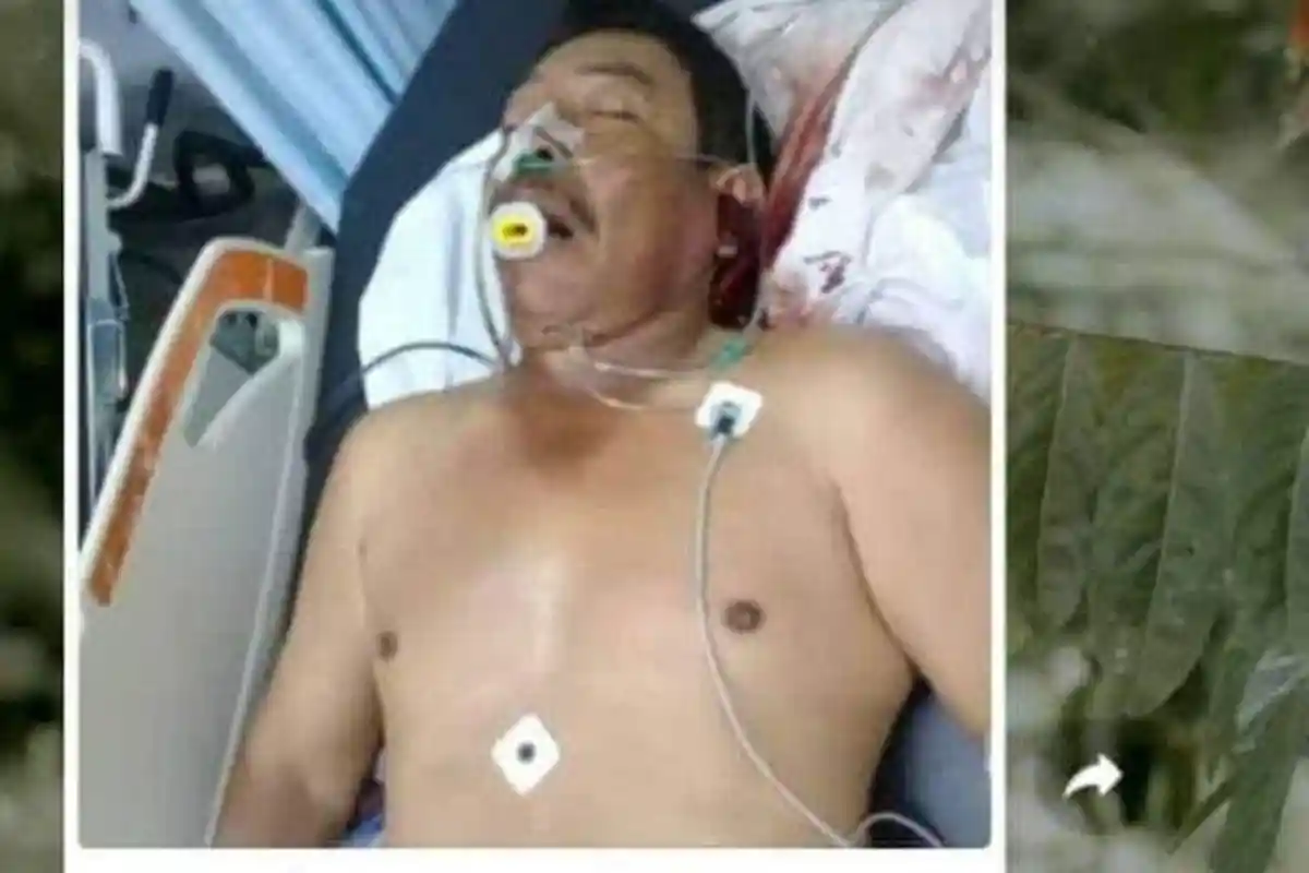 Pasien Kritis Bernama Muhammad Nasir yang Sempat  Menyebar di Medsos Akhirnya Meninggal di RSUZA