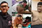 masih-ingat-arya-permana-anak-tergemuk-di-dunia-dulu-192-kilogram-kabarnya-kini-berubah-drastis.jpg
