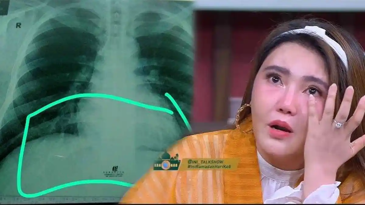 Curhat Via Vallen Saat Adik Dinyatakan Positif Corona, Didatangi Satpol PP Hingga Disindir Tetangga