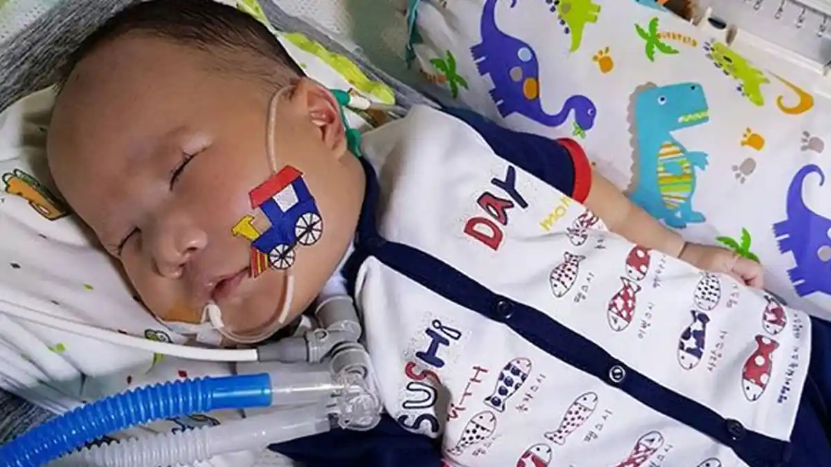 Pentingnya Pemenuhan Nutrisi Medis Khusus Cegah Malnutrisi Bagi Anak Berpenyakit Langka