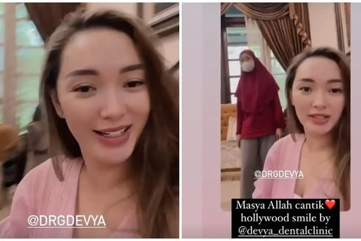 Zaskia Gotik Ikut Tren Hollywood Smile, Istri Sirajuddin Mahmud Pasang Veneer Gigi di drg Devya