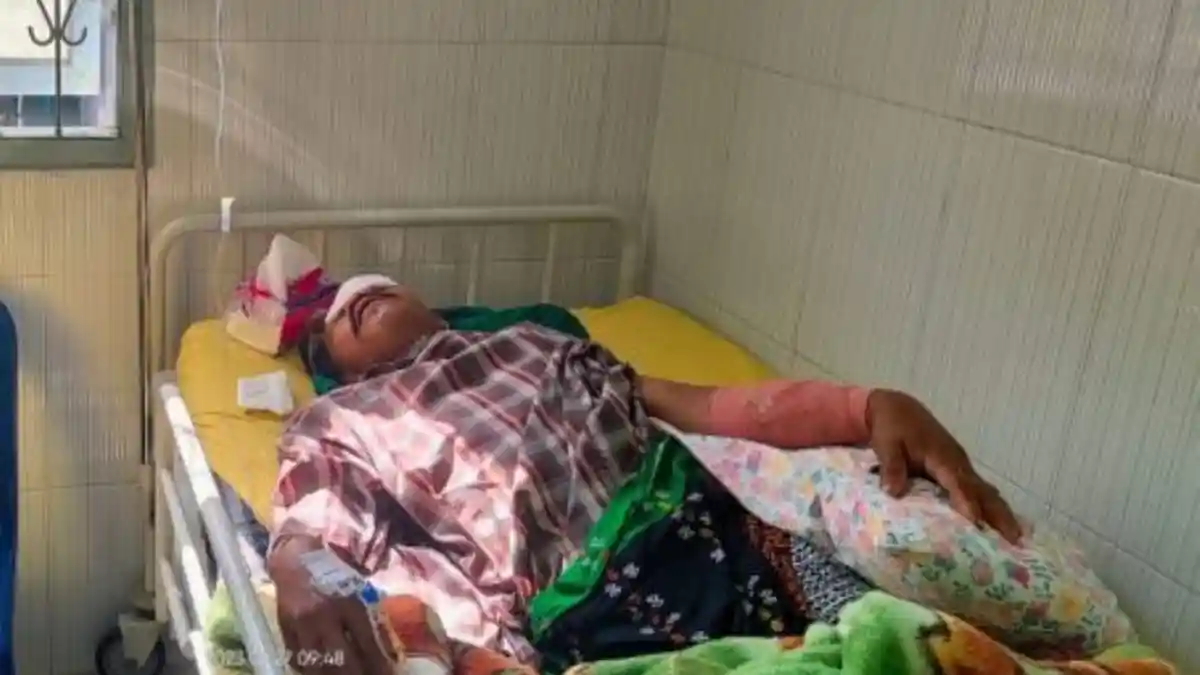 Baru Saja Memesan Tuak, Rajin Manalu Dibacoki Hingga Tangan Nyaris Putus