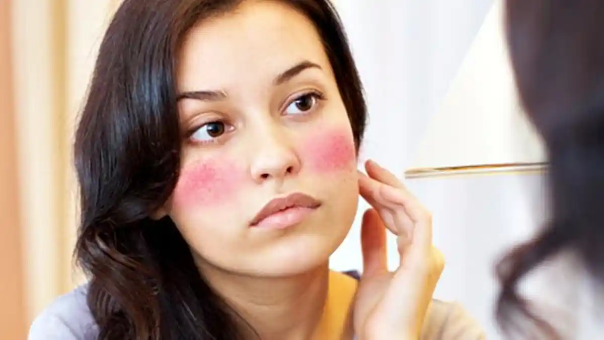Cuaca Panas Bisa Bikin Kulit Terbakar, Ini Tips Memilih Sunscreen untuk Kulit Sensitif