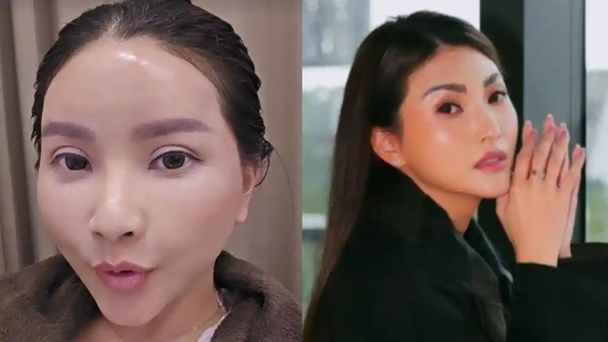 Muka Sarwendah Pasca 10 Hari Oplas, Istri Ruben Onsu Curhat Harus Keramas di Salon: Takut Kegaruk