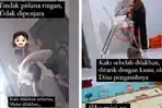 Kekerasan-terhadap-balita-kembali-terjadi.jpg