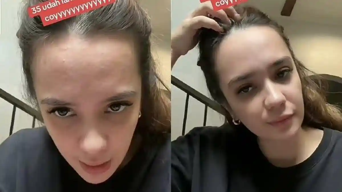 Putri Anne Pamer Rambut Beruban Usai Cerai dari Arya Saloka