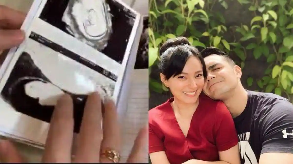 Asmirandah Sempat Sedih Program Bayi Tabungnya Nyaris Tertunda,  Ini Masalah yang Mereka Hadapi