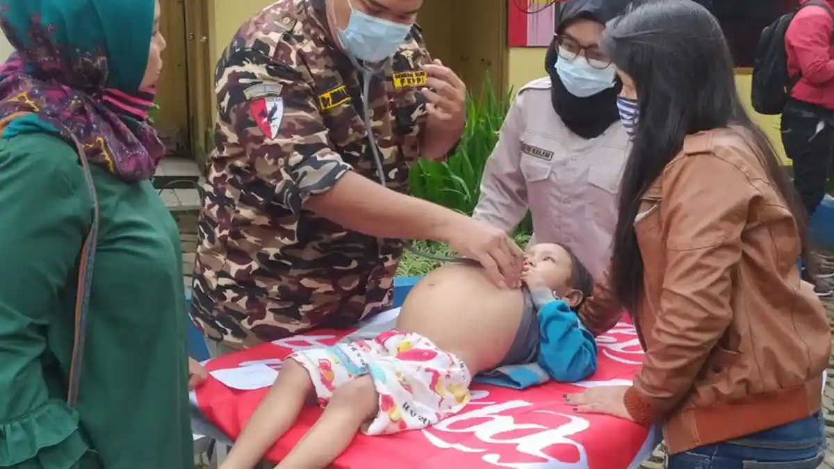Tubuh Kurus Perut Membuncit, Tak Ada Biaya, Bocah Keluarga Pengamen Ini Harus Segera Dioperasi