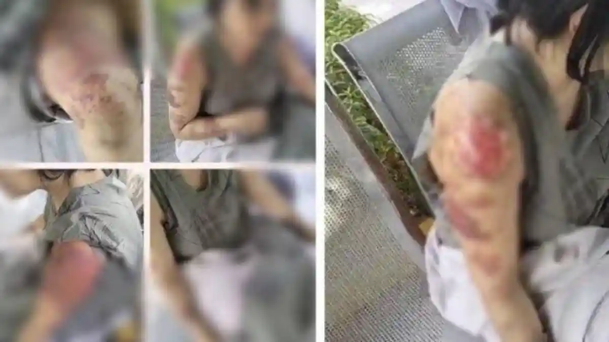 Nasib Nurlela, TKW yang Disiksa dan Disekap di Arab Saudi, Berhasil Melarikan Diri, Pelaku Terungkap