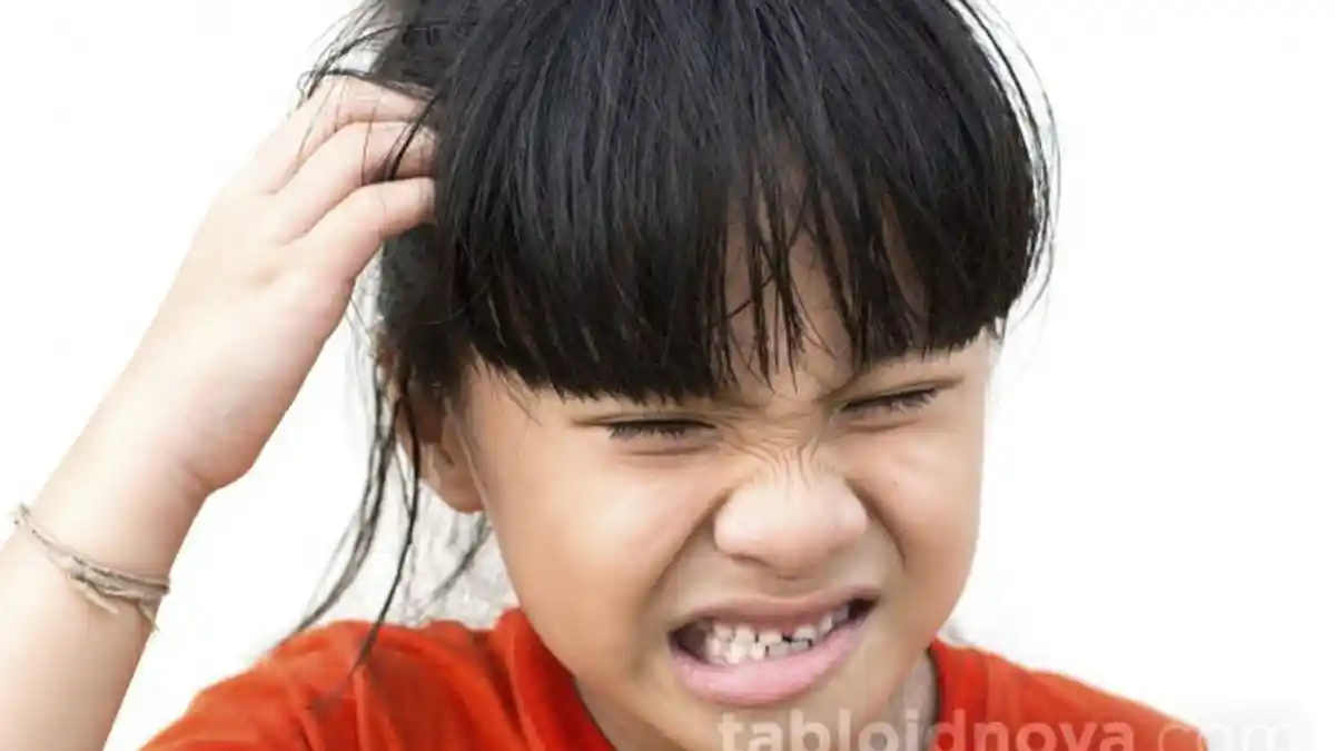 Anak Ibu Kutuan? Tenang Ini Cara Mengatasi Kutu Rambut