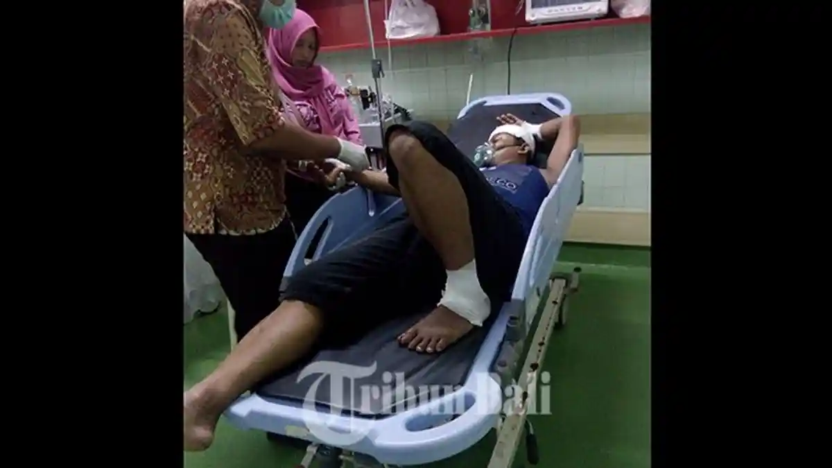 Bakar Sate untuk Rayakan Tahun Baru di Denpasar, Kepala Marjoko Tersambar Api hingga Luka Parah