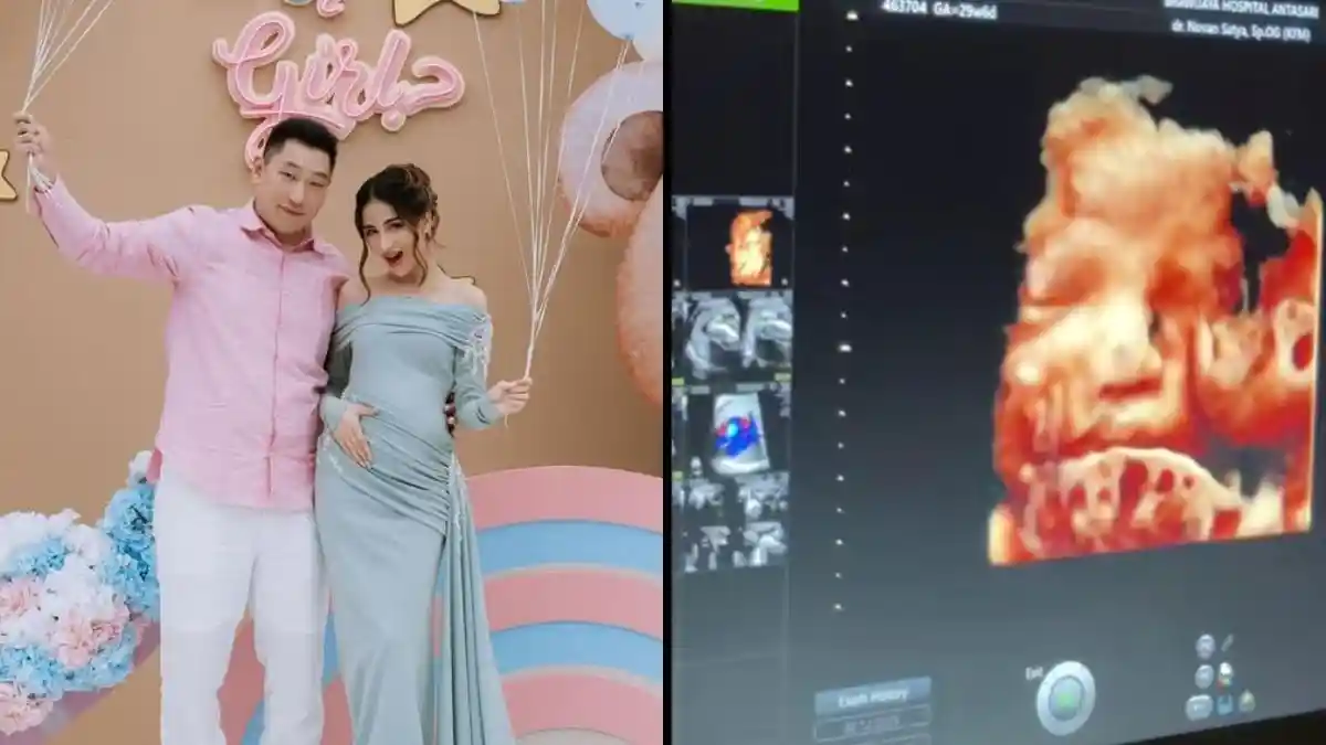 Momen Haru Sabrina Adfi dan Stenly Lihat Baby Archin Lewat USG 4D, Bikin Penasaran