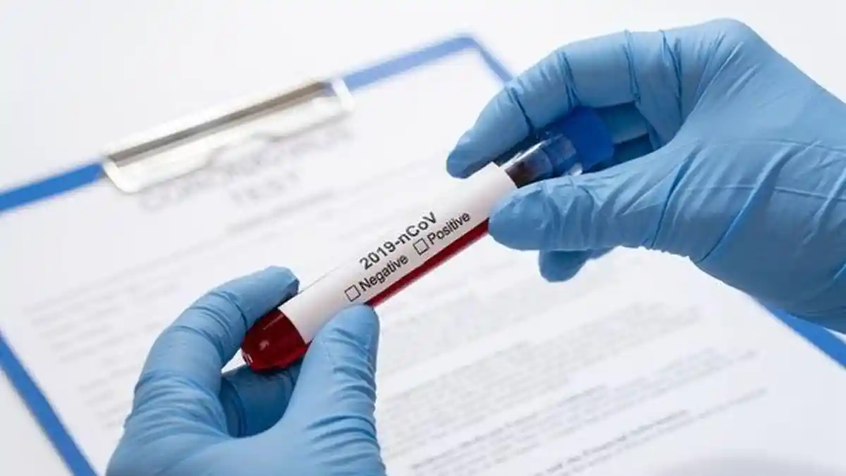 Varian Lambda, Label yang WHO Berikan kepada Varian Baru Virus Corona
