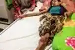 Anak Diamputasi Membutuhkan Bantuan