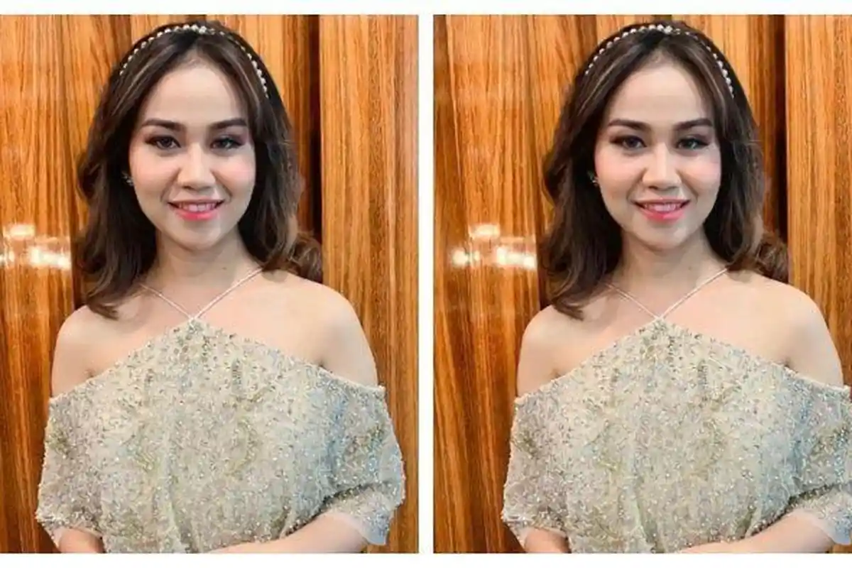 Mayang Adik Vanessa Angel Lakukan Operasi Hidung, Ini Alasannya