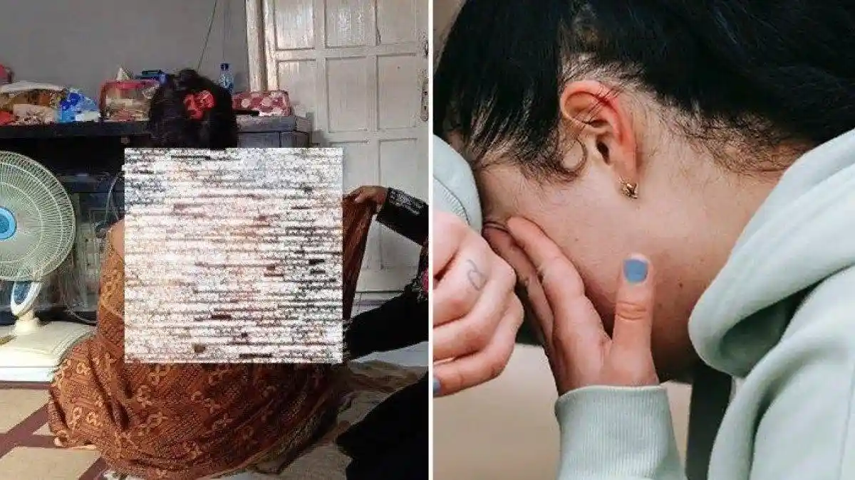 Suami Siram Istri dengan Air Panas Gegara Kesal Diminta Cerai dan Pamit ke Jakarta, Tubuh Melepuh