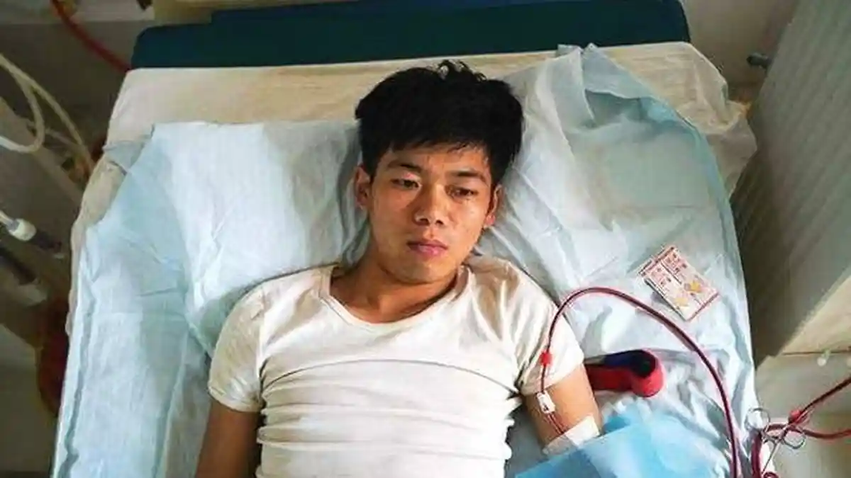 Kisah ABG yang Nekat Jual Ginjal Untuk Beli iPhone, Kini Nasibnya Mengenaskan, Divonis Cacat Berat