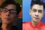 Veri AFI Dulu Jadi Idola, Kini Kondisi Fisiknya Buat Fans Prihatin, Tubuh Kurus, Mata Kiri Buta