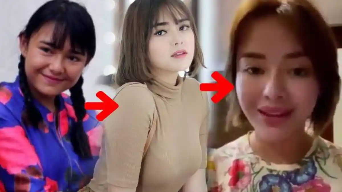 Bibir 'Dower' Amanda Manopo Diprotes Fans Ikatan Cinta, Ternyata Ada Masalah Kesehatan