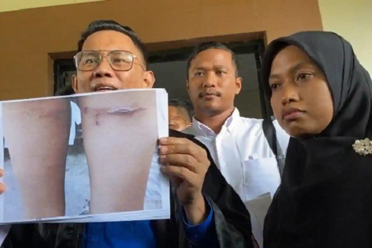Hasil Visum Anak Aipda WH Janggal, Pengacara Guru Supriyani Soroti Dokter : Dinilai Tak Kompeten