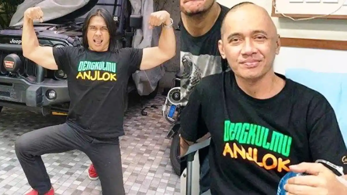 Penampilan Agung Hercules Berubah Drastis, Badan Kurus Botak dan Dirawat di RS, Para Artis Kirim Doa