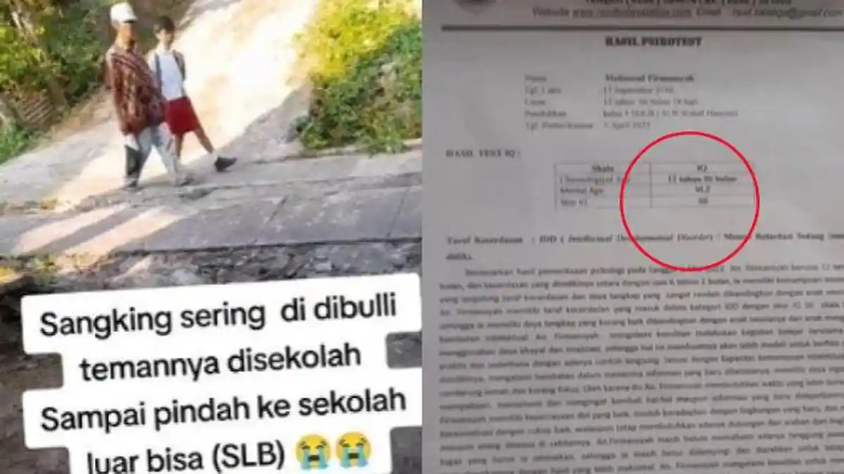 FAKTA Bocah SD Pindah SLB karena Dibully Teman, Hasil Psikotes Ternyata di Bawah Rata-rata: Lemah