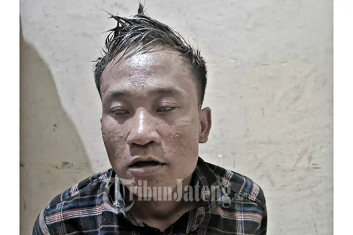 Wajah Hasan Begal Sadis Mesuji, Pembunuh Sopir Truk Ayam, Kaki Kirinya Dilubangi Polisi