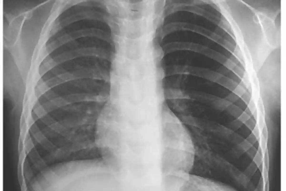 Gejala Virus Corona, Kenali Batuk Flu Biasa dengan Infeksi covid-19, Tak Pernah Dirasakan Sebelumnya