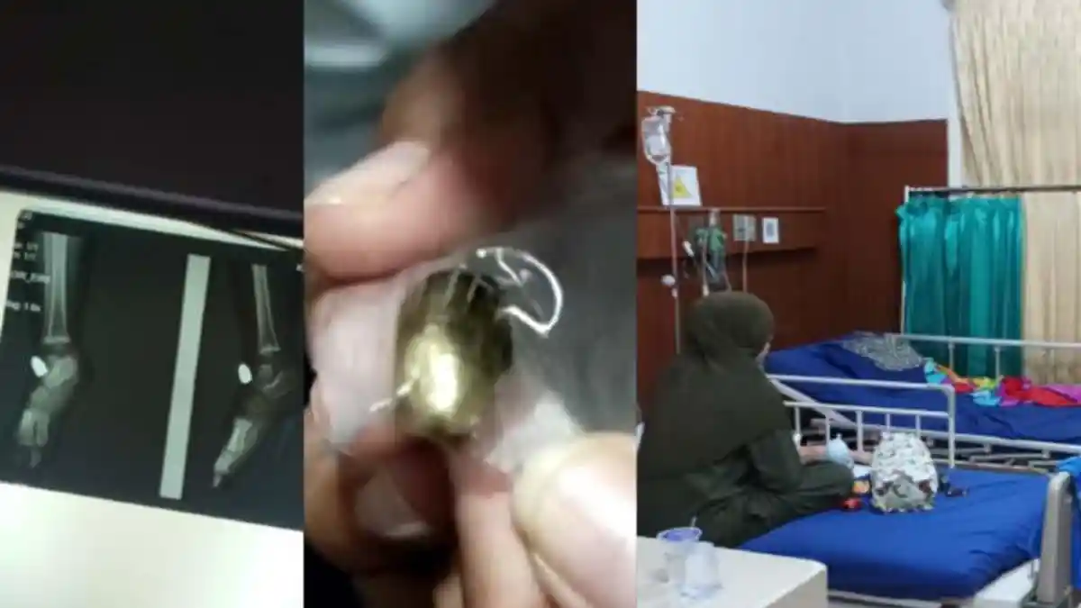 Bayi Tertembak Peluru Nyasar di Bandar Lampung Sudah Diperbolehkan Pulang dari RS