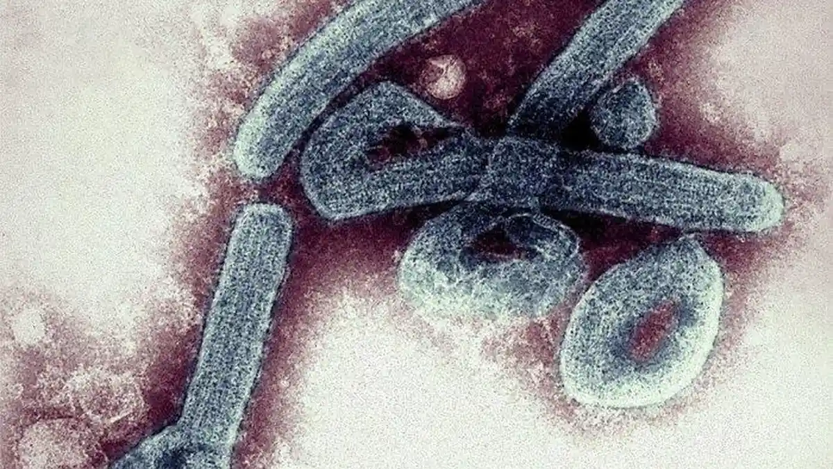 Kenali Gejala Virus Marburg, Mirip Virus Ebola dan Lebih Mematikan dari Covid-19