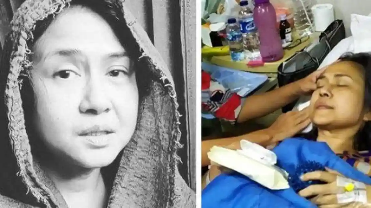 Idap Kanker, Kondisi Ria Irawan Diungkap Aldi Taher, 10 Kali Radioterapi di Kepala