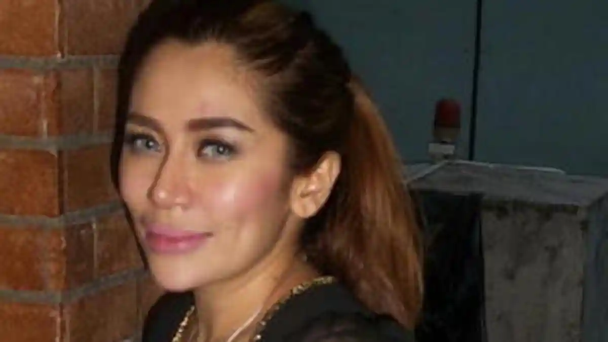 Tangan Terluka dan Bibir Bengkak, Cinta Penelope Bantah Alami KDRT