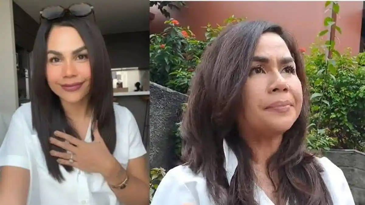 Kondisi Wajahnya Terekam Kamera Wartawan, Melaney Ricardo: Artis Bukan Barbie, Bopeng Bukan Aib